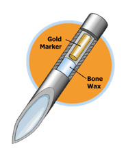 Fiducial Markers